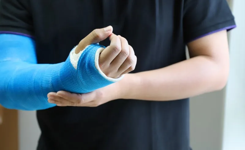 Closeup of man's arm with long arm plaster, fiberglass cast therapy cover by blue elastic bandage after sport accident.